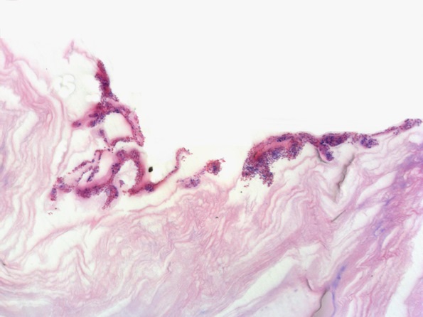 グラム染色（研磨切片-細菌）