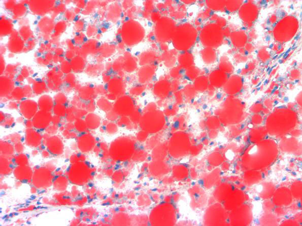 オイルレッドO脂肪染色