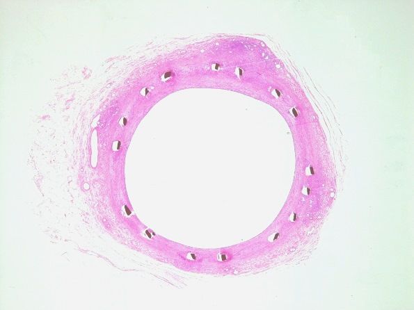 HE染色-1（ステント血管）
