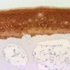 Collagen TypeⅡ抗体染色（ブタ）