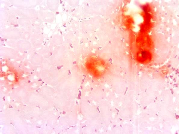アリザリン赤染色（石灰化）