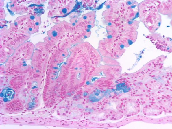 アルシアン青染色