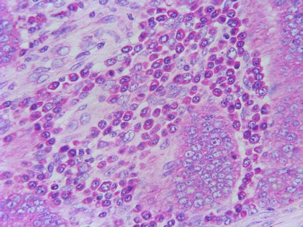 メチルグリーンピロニン染色